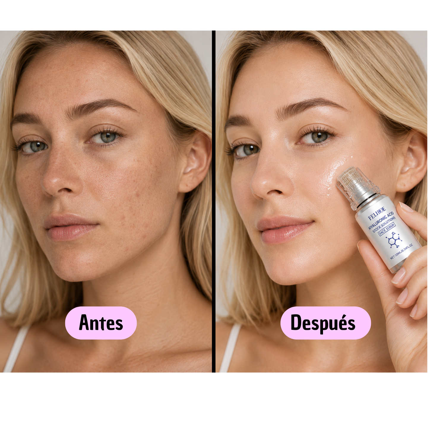 Kit Profesional de Microneedling Facial